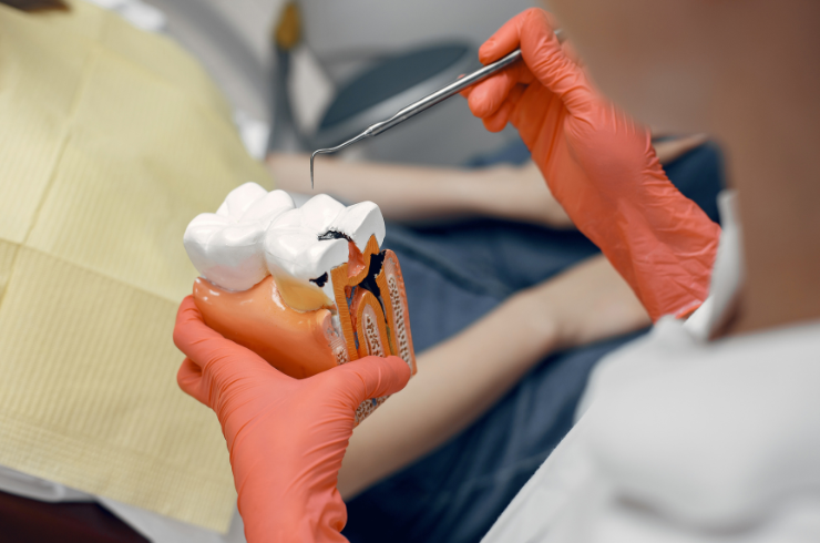 Root canal treatment